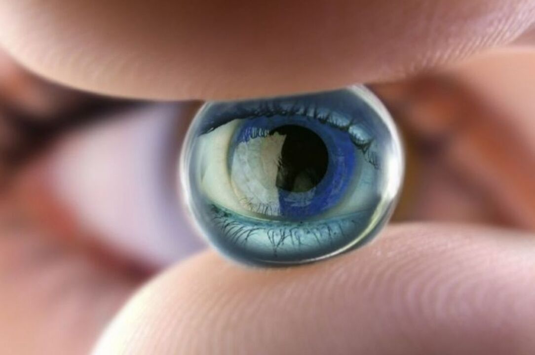 View Lenses