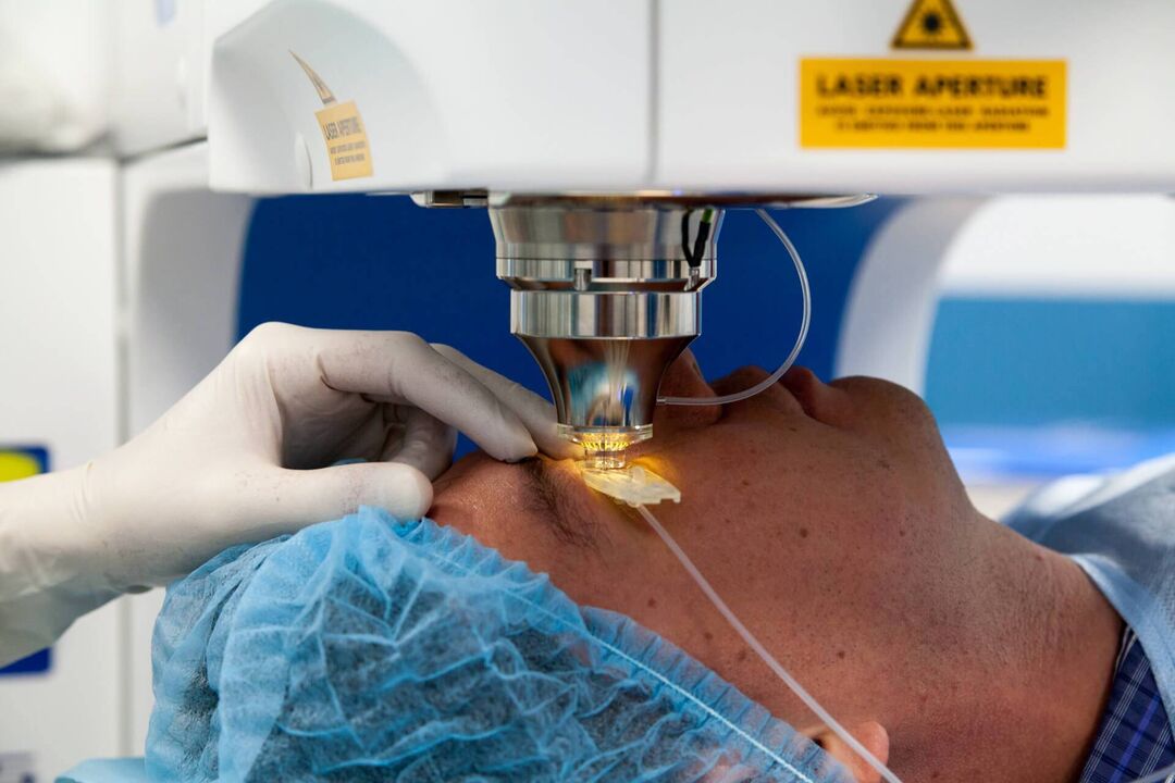 laser surgery to restore vision